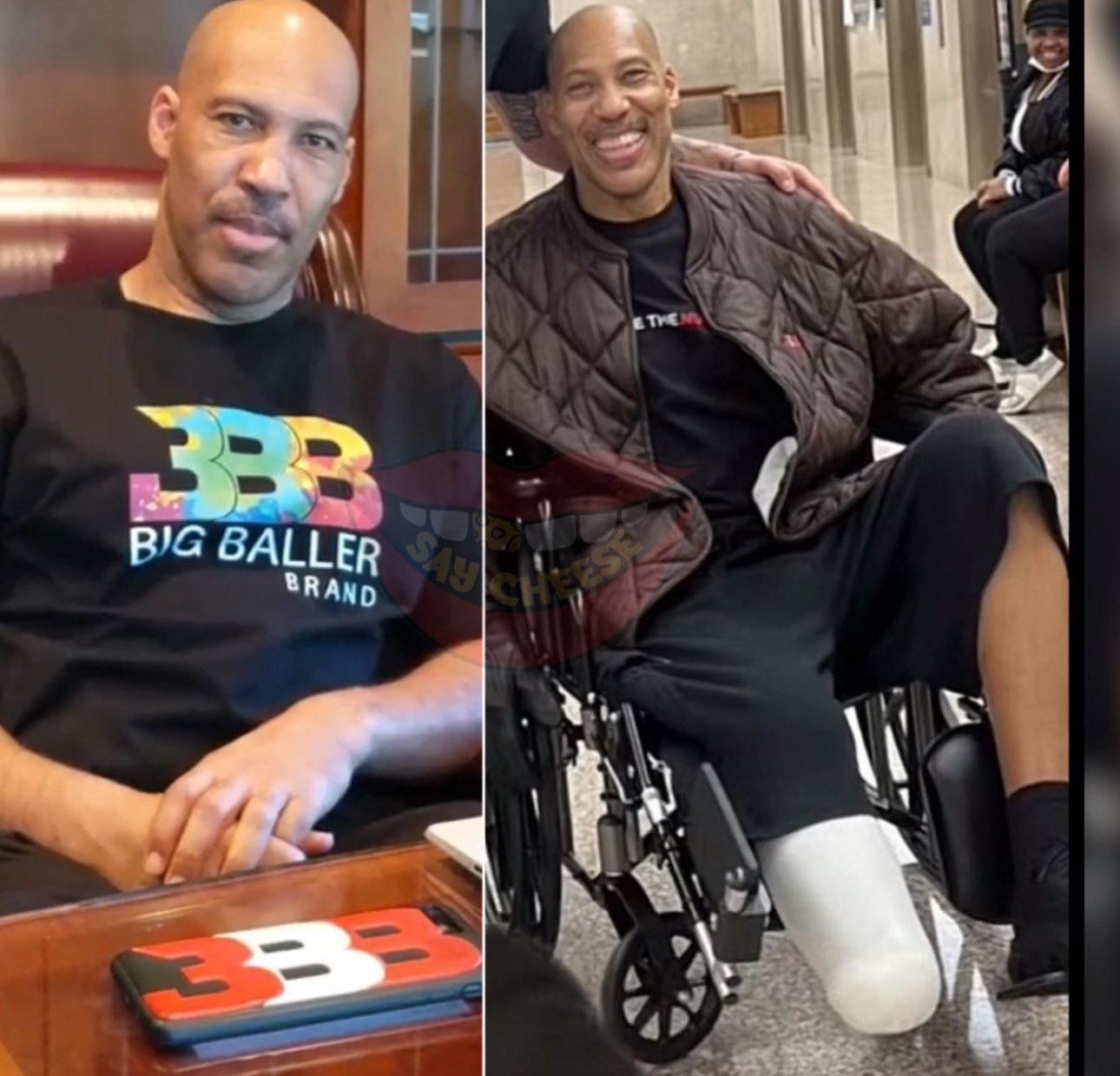 LaVar Ball had to have his foot amputated after suffering a serious medical issue.